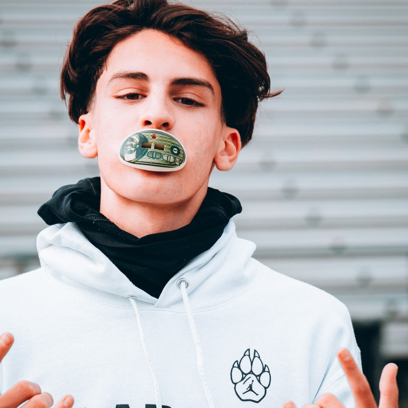 Load image into Gallery viewer, MONEY - Lip Protector Mouthguard